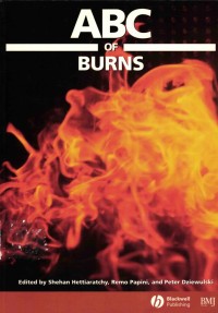 Image of ABC Of Burns