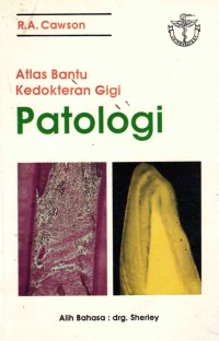 Image of Atlas Bantu Kedokteran Gigi Patologi