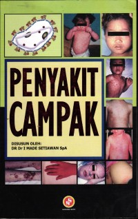 Image of Penyakit Campak
