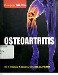 Image of Osteoartritis