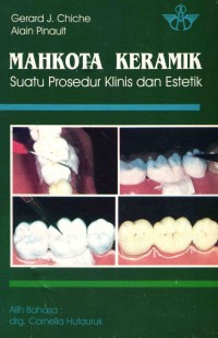 Image of Mahkota Keramik :Suatu Prosedur Klinis dan Estetik