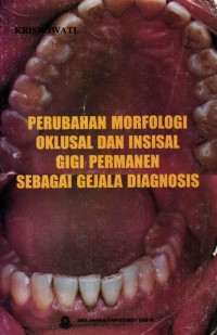 Image of Perubahan Morfologi Oklusal Dan Insisal Gigi Permanen Sebagai Gejala Diagnosis