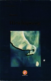 Image of Penyakit Hirschsprung